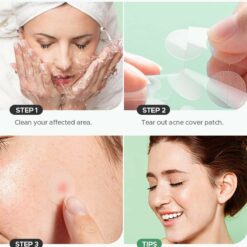 72 Invisible Pimple Patches