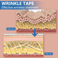 Face Lift Tape - Kinesiology Tape