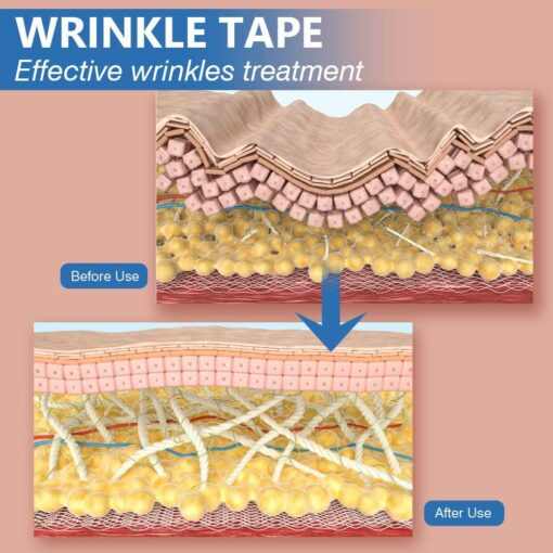 Face Lift Tape - Kinesiology Tape